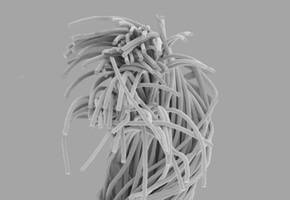 电子显微镜图片：纤维素混纺綿